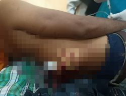 Dipicu Masalah Batas Tanah, Kakek di Jember Bacok Tetangga Pakai Clurit