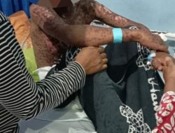 Viral Bocah Melepuh Setelah Mandi Disungai, Polisi Langsung Dalami Kasus Ini